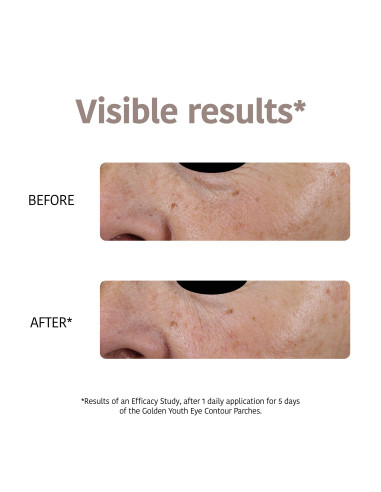 IROHA NATURE Patches - mask med 24K...