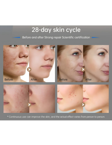 Dr. Pen M9 microneedlingpenna 2.0 –...