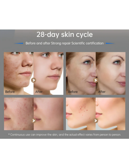 Dr. Pen M9 microneedlingpenna 2.0 – smart microneedling i nästa generation