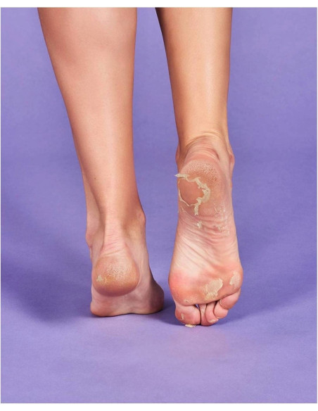 Iroha Nature exfolierande maskstrumpor för fötterna med glykolsyra och lavendel för borttagning av död hud och förhårdnader, 1 p