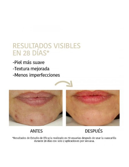 IROHA NATURE Peeling ansiktsmask med glykolsyra 23 ml