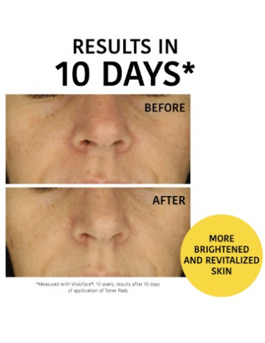IROHA NATURE Peeling och Brightening...
